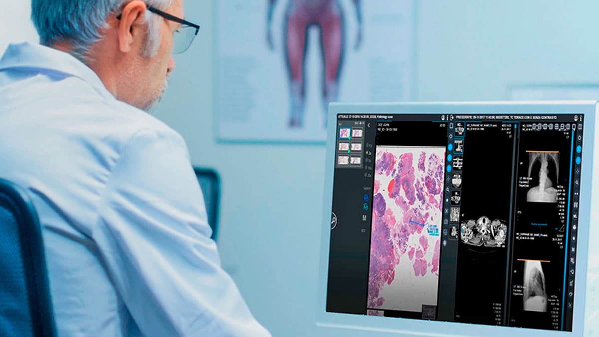 Profesional sanitario analiza pruebas médicas con inteligencia artificial para la detección precoz del cáncer