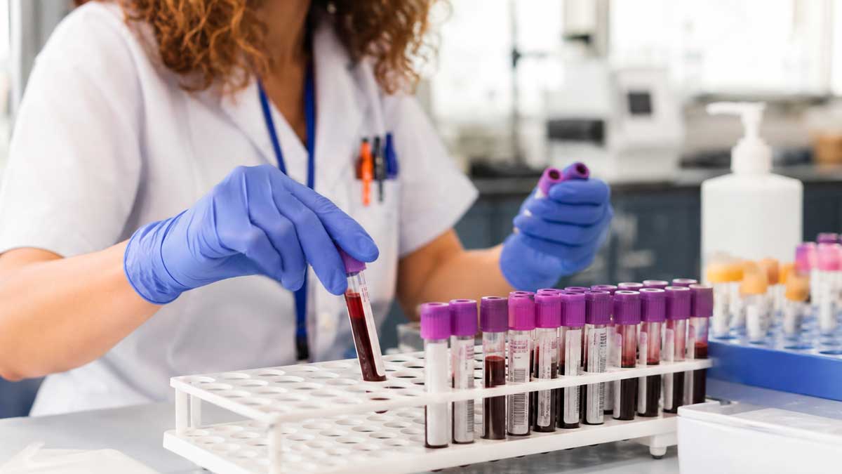 Profesional sanitario manipula muestras de sangre para un estudio sobre riesgo cardiovascular con voluntarios en Sevilla