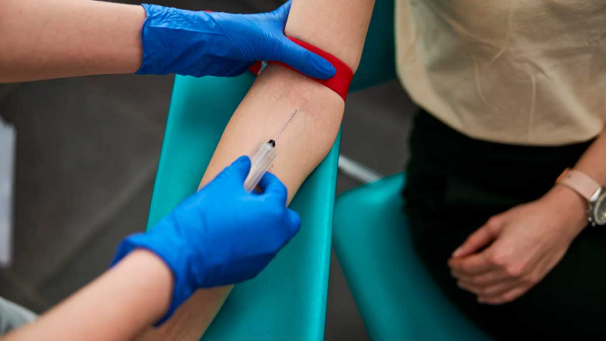 Extracción de sangre para análisis que predice riesgo de alzhéimer