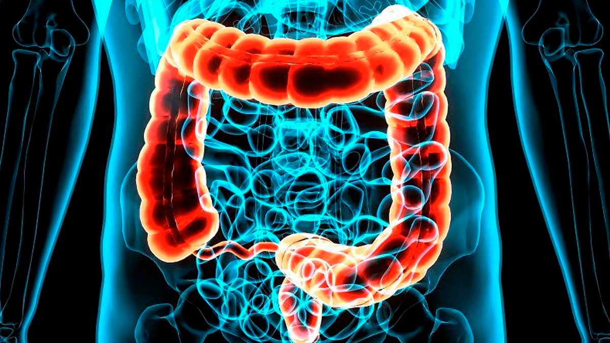Imagen del intestino grueso humano resaltado, relacionada con el viroma del intestino